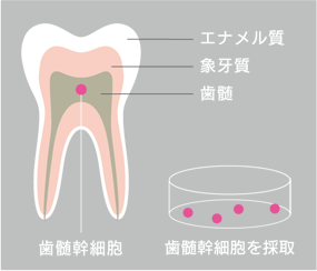 歯髄幹細胞イメージ